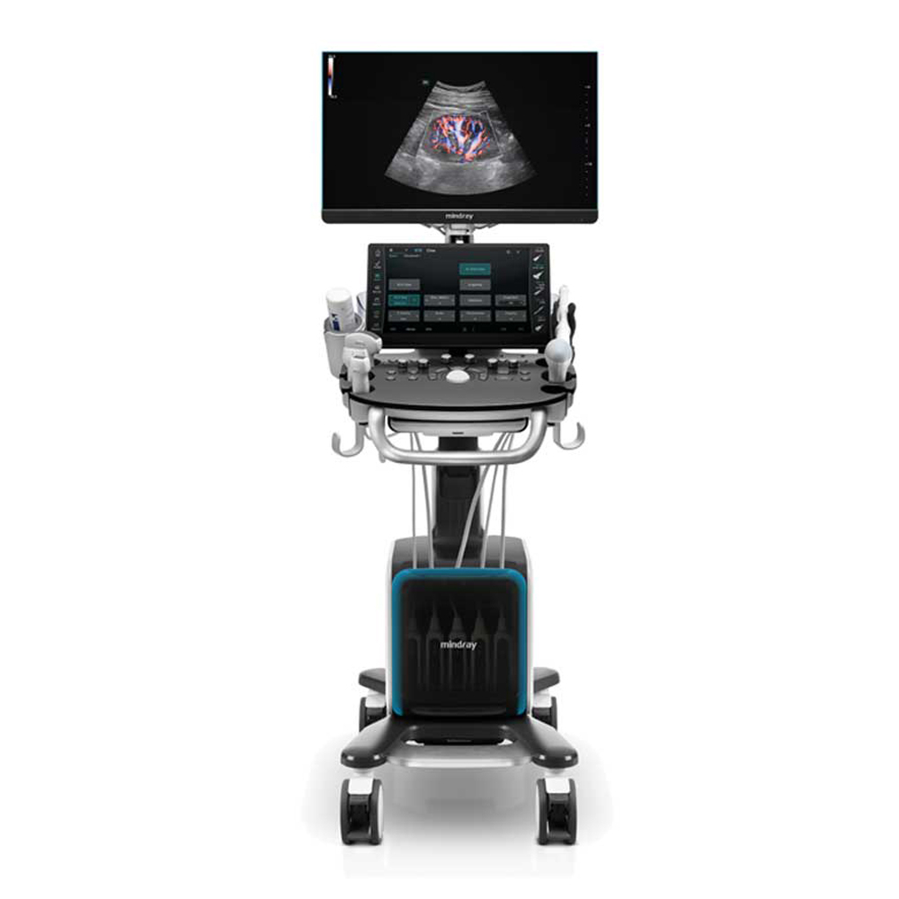 Фото ультразвукового аппарата Mindray Consona N9
