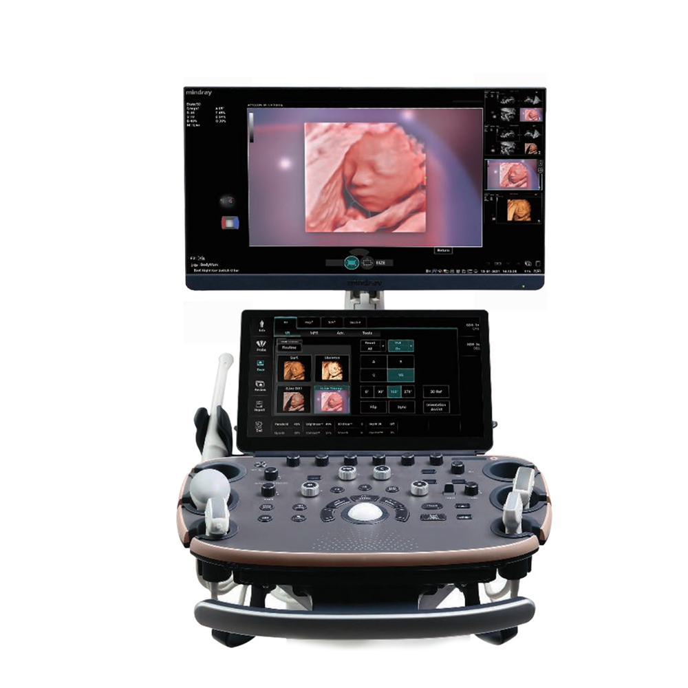 Фото ультразвукового аппарата Mindray Imagyn I9